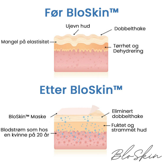 Le BloSkin™ Løft